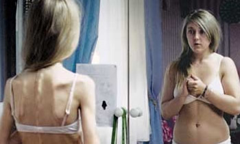Anorexia e Bulemia